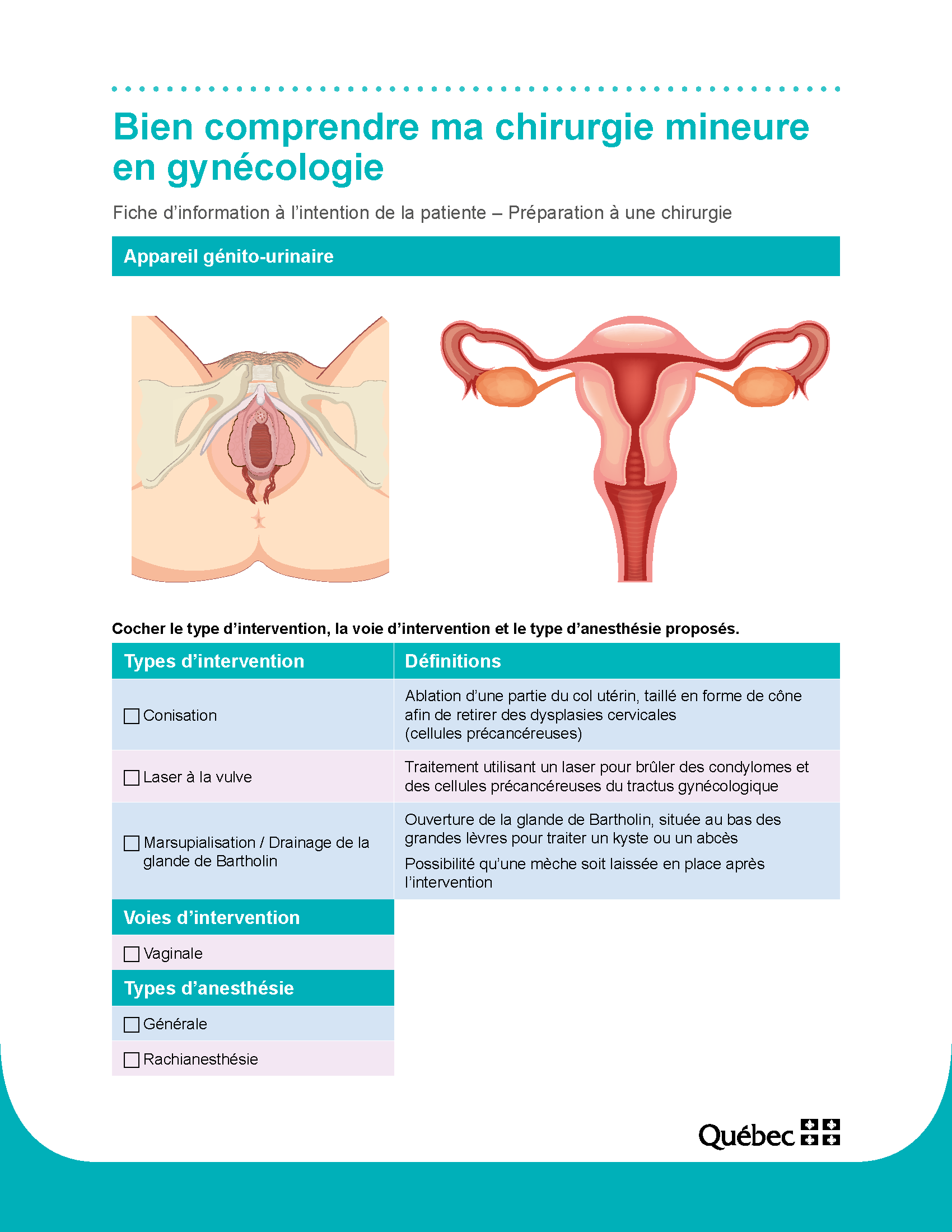 bien-comprendre-ma-chirurgie-mineure-en-gynecologie--cpsfe138(2018)