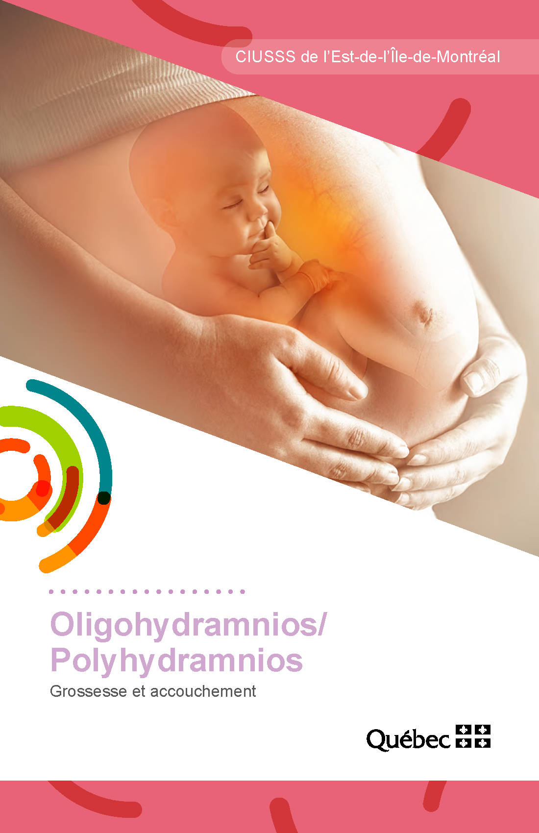 oligohydramnios-polyhydramnios--cpsfe183(2023)